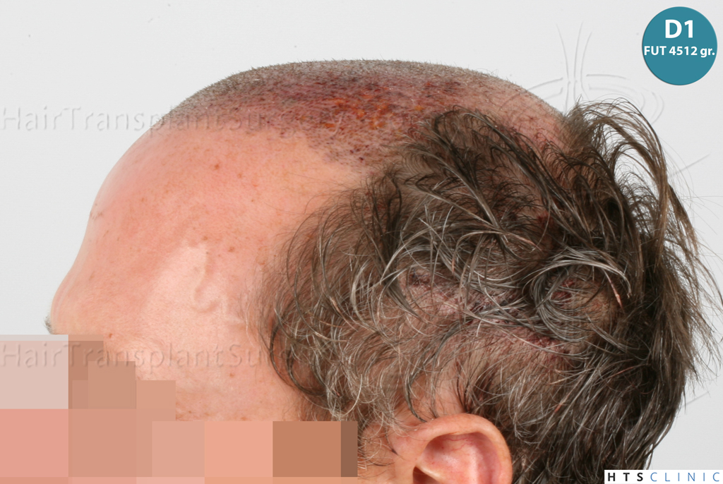 Dr.Devroye-Montesanti-Jenard-HTS-Clinic-