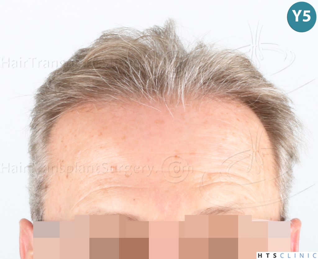 Dr.Devroye-Montesanti-Jenard-HTS-Clinic-