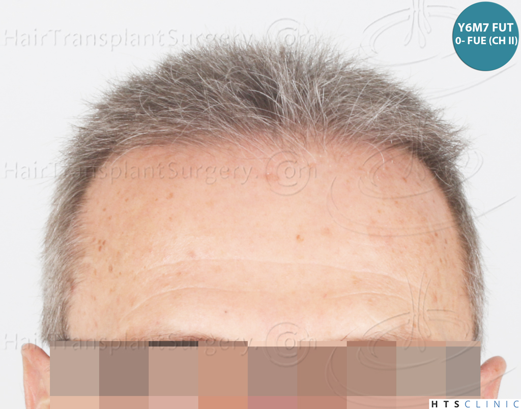 Dr.Devroye-Montesanti-Jenard-HTS-Clinic-