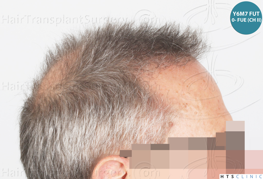 Dr.Devroye-Montesanti-Jenard-HTS-Clinic-