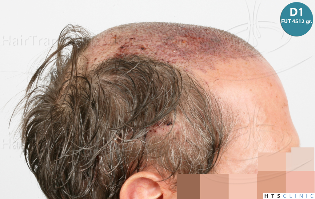 Dr.Devroye-Montesanti-Jenard-HTS-Clinic-