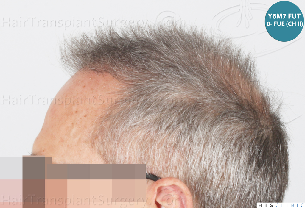 Dr.Devroye-Montesanti-Jenard-HTS-Clinic-