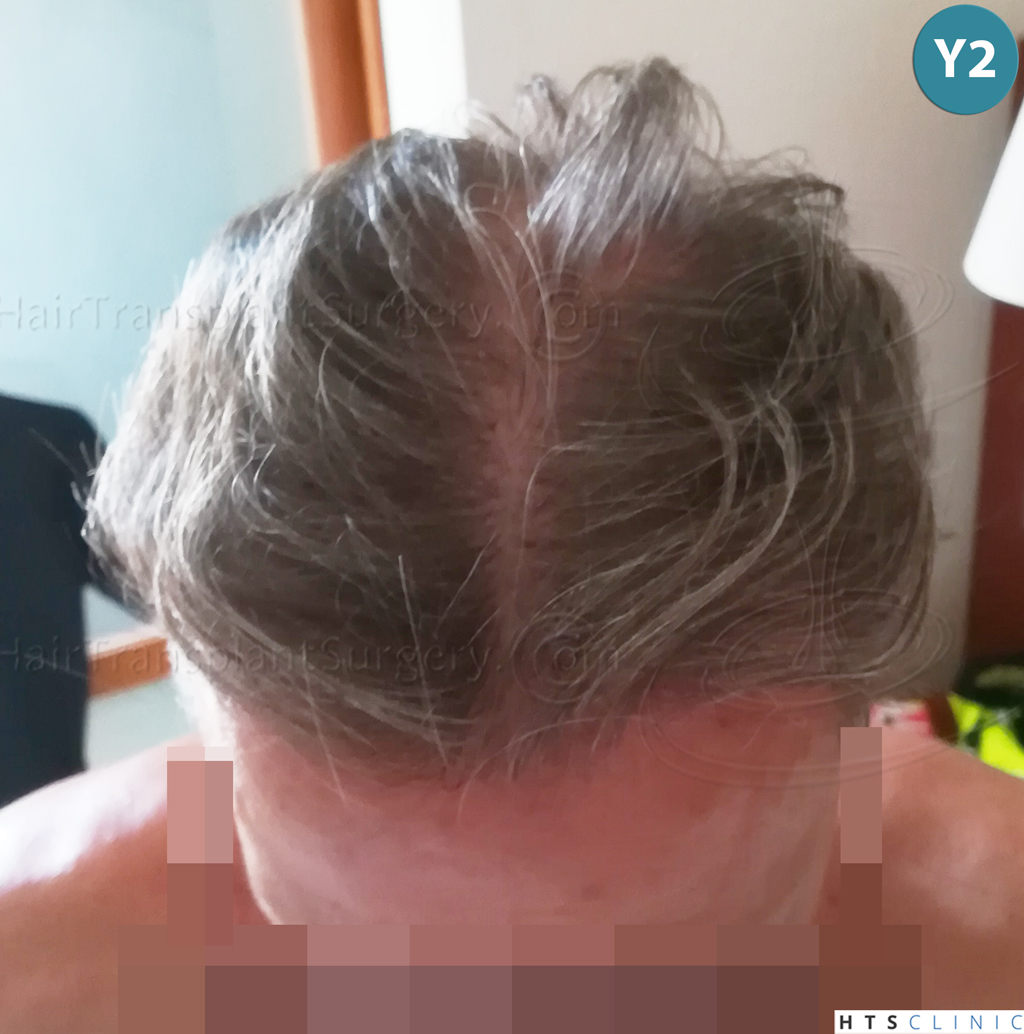 Dr.Devroye-Montesanti-Jenard-HTS-Clinic-