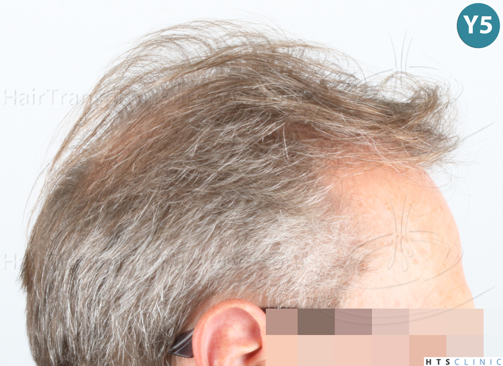Dr.Devroye-Montesanti-Jenard-HTS-Clinic-
