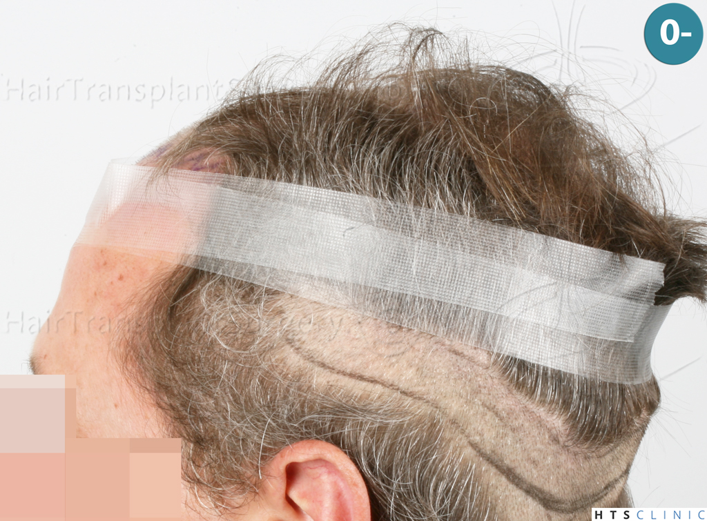 Dr.Devroye-Montesanti-Jenard-HTS-Clinic-