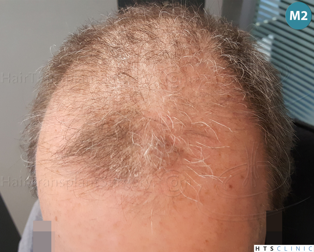 Dr.Devroye-Montesanti-Jenard-HTS-Clinic-