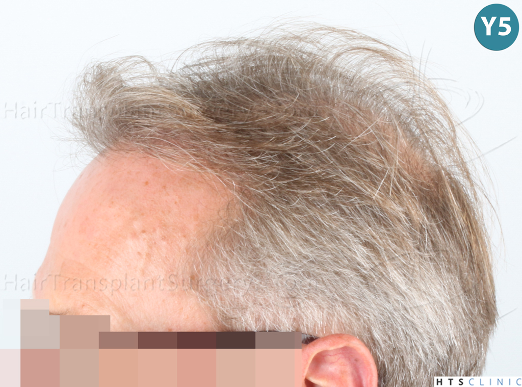 Dr.Devroye-Montesanti-Jenard-HTS-Clinic-