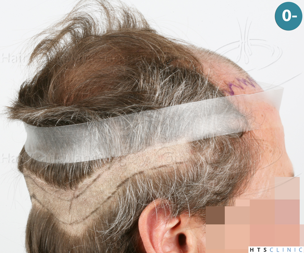 Dr.Devroye-Montesanti-Jenard-HTS-Clinic-