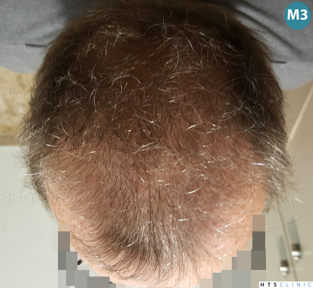 Dr.Devroye-Montesanti-Jenard-HTS-Clinic-