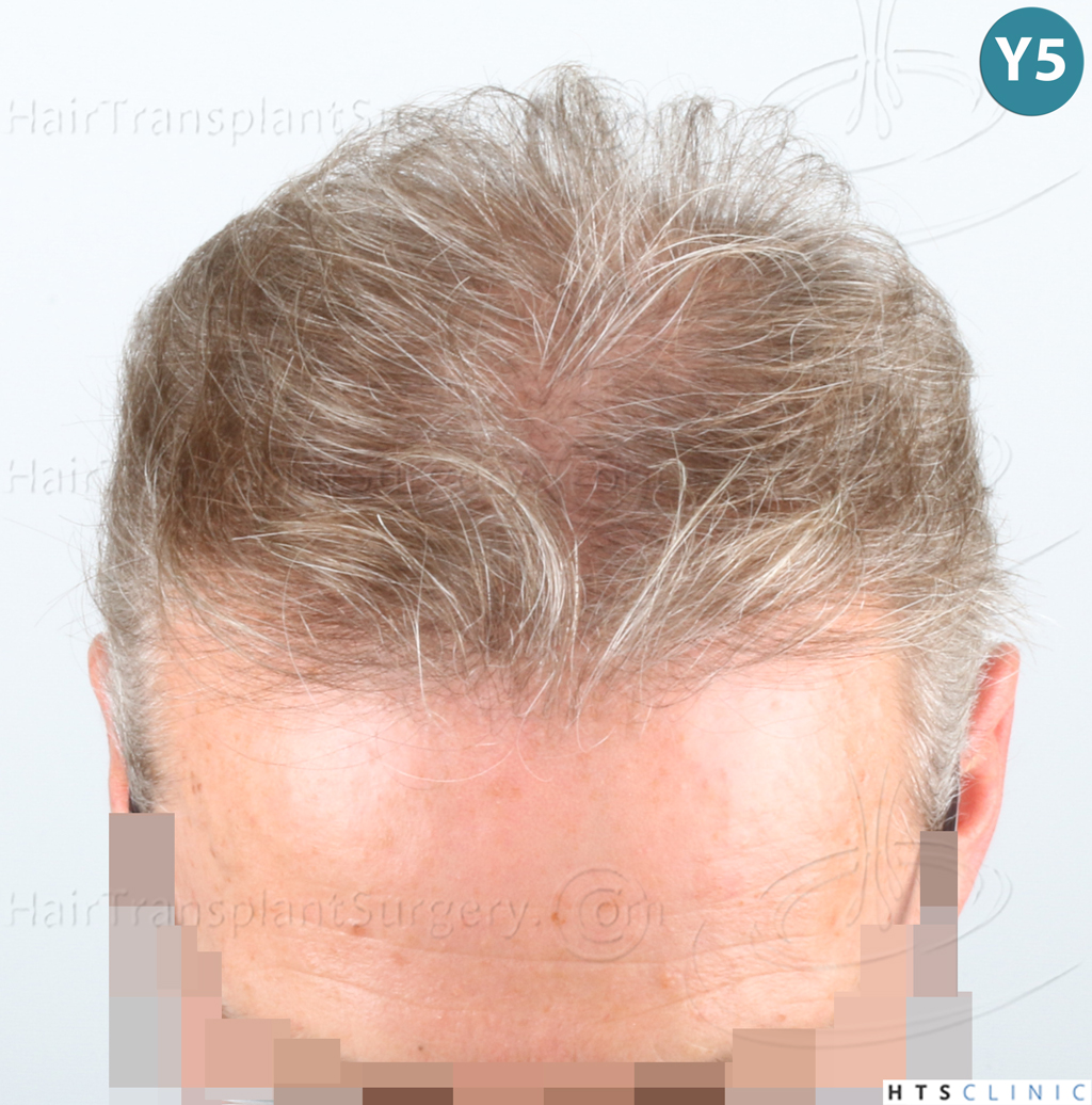 Dr.Devroye-Montesanti-Jenard-HTS-Clinic-