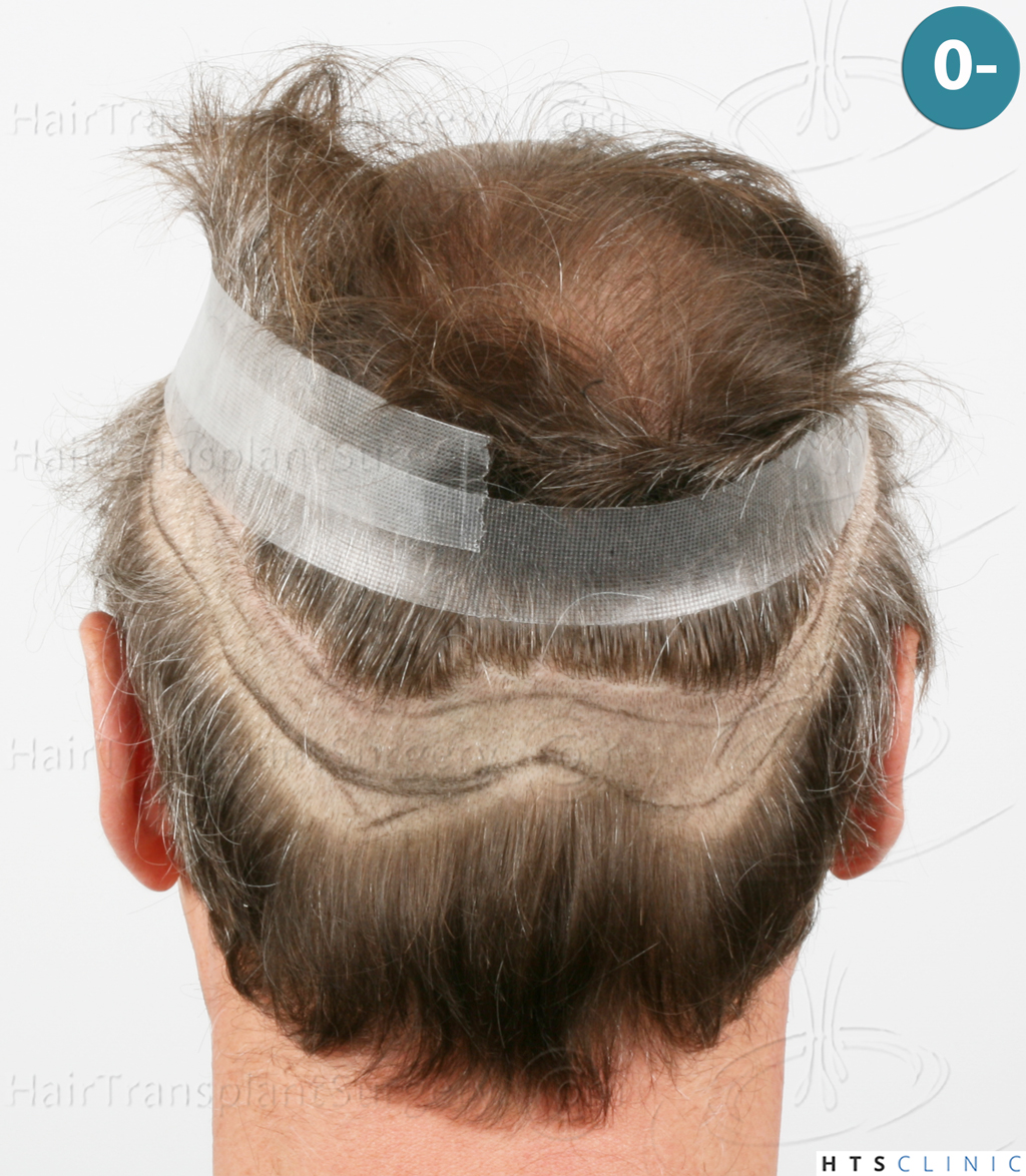 Dr.Devroye-Montesanti-Jenard-HTS-Clinic-