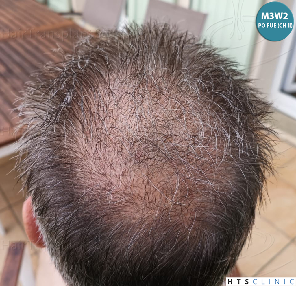 Dr.Devroye-Montesanti-Jenard-HTS-Clinic-