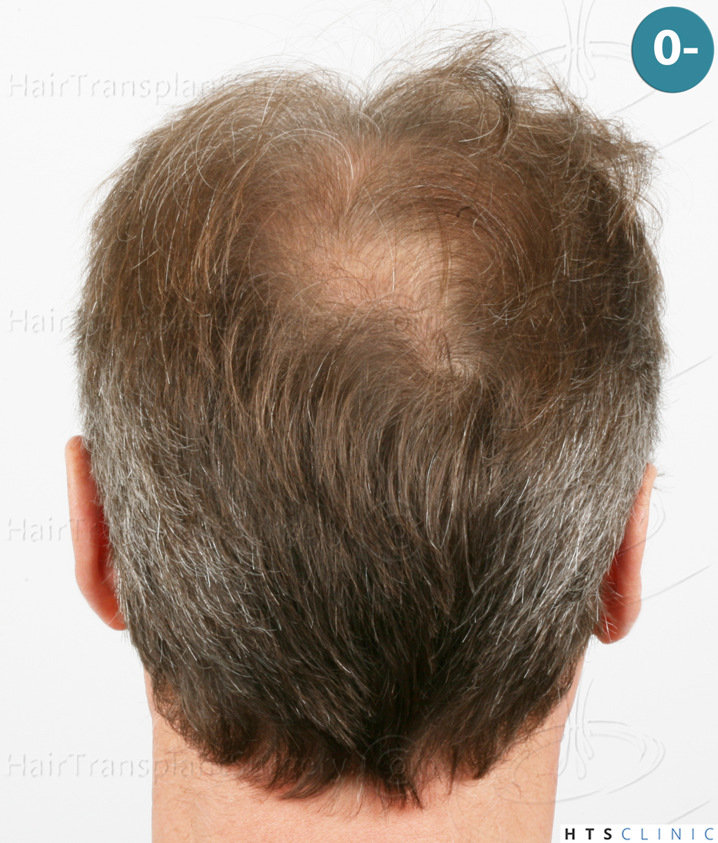 Dr.Devroye-Montesanti-Jenard-HTS-Clinic-