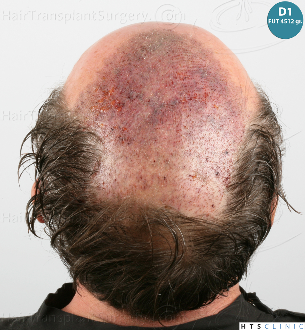 Dr.Devroye-Montesanti-Jenard-HTS-Clinic-