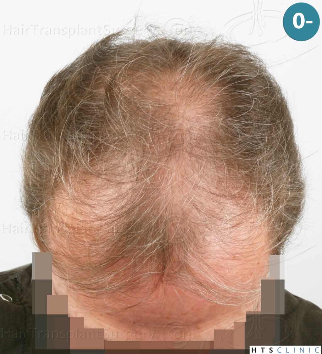 Dr.Devroye-Montesanti-Jenard-HTS-Clinic-