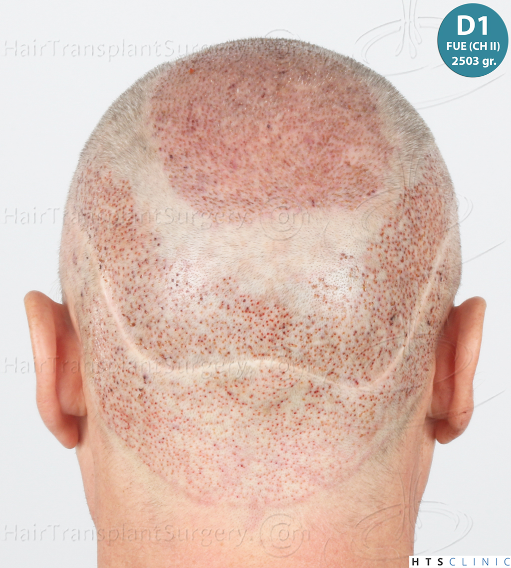 Dr.Devroye-Montesanti-Jenard-HTS-Clinic-