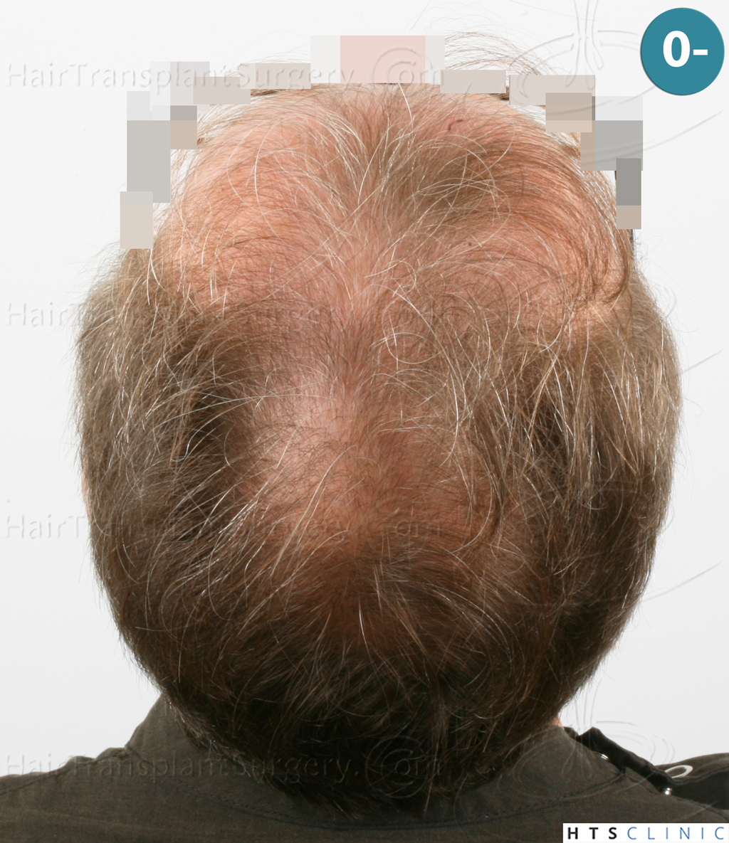 Dr.Devroye-Montesanti-Jenard-HTS-Clinic-