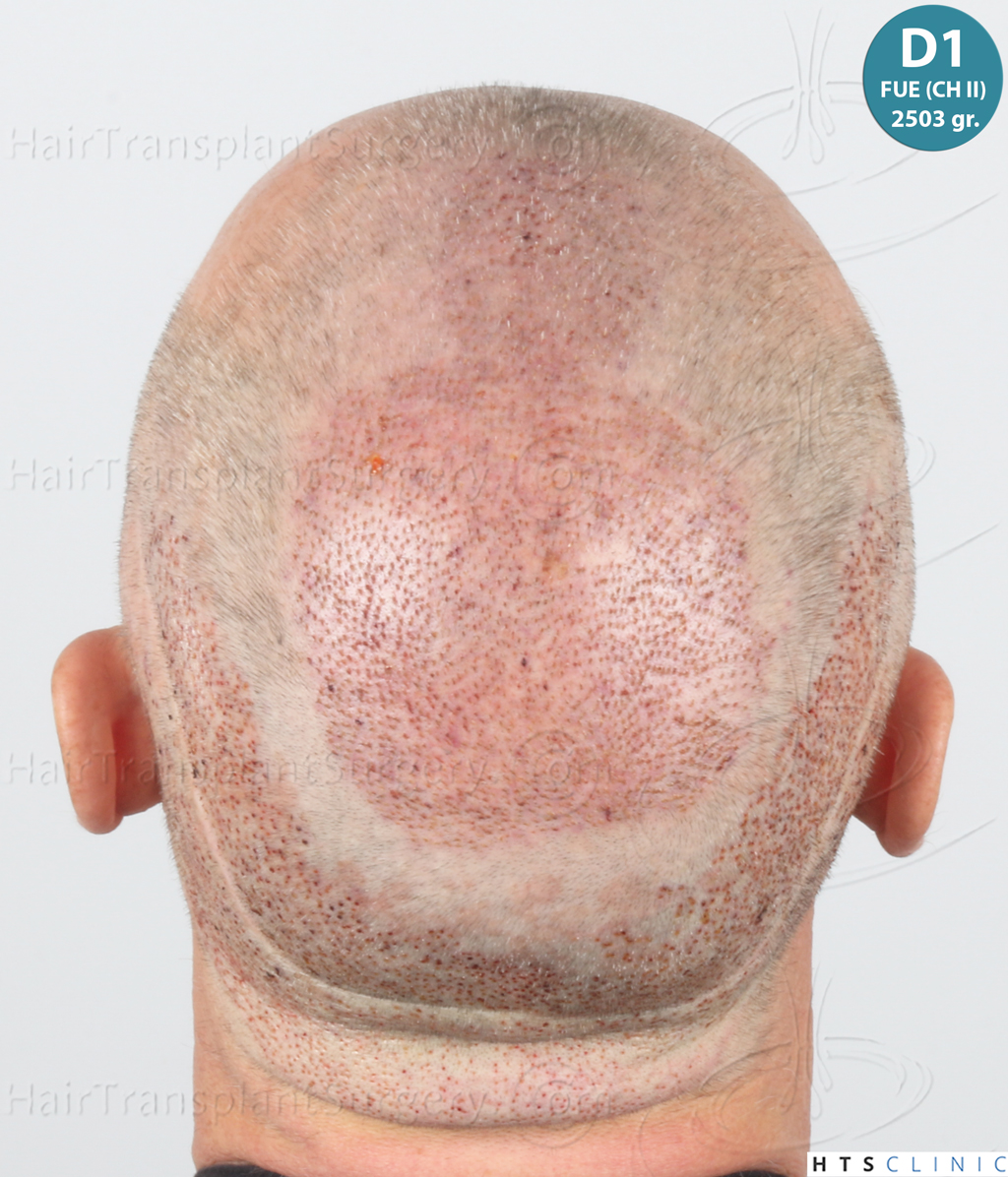 Dr.Devroye-Montesanti-Jenard-HTS-Clinic-