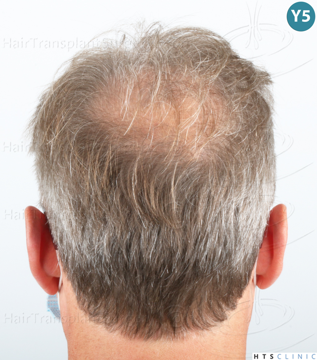 Dr.Devroye-Montesanti-Jenard-HTS-Clinic-