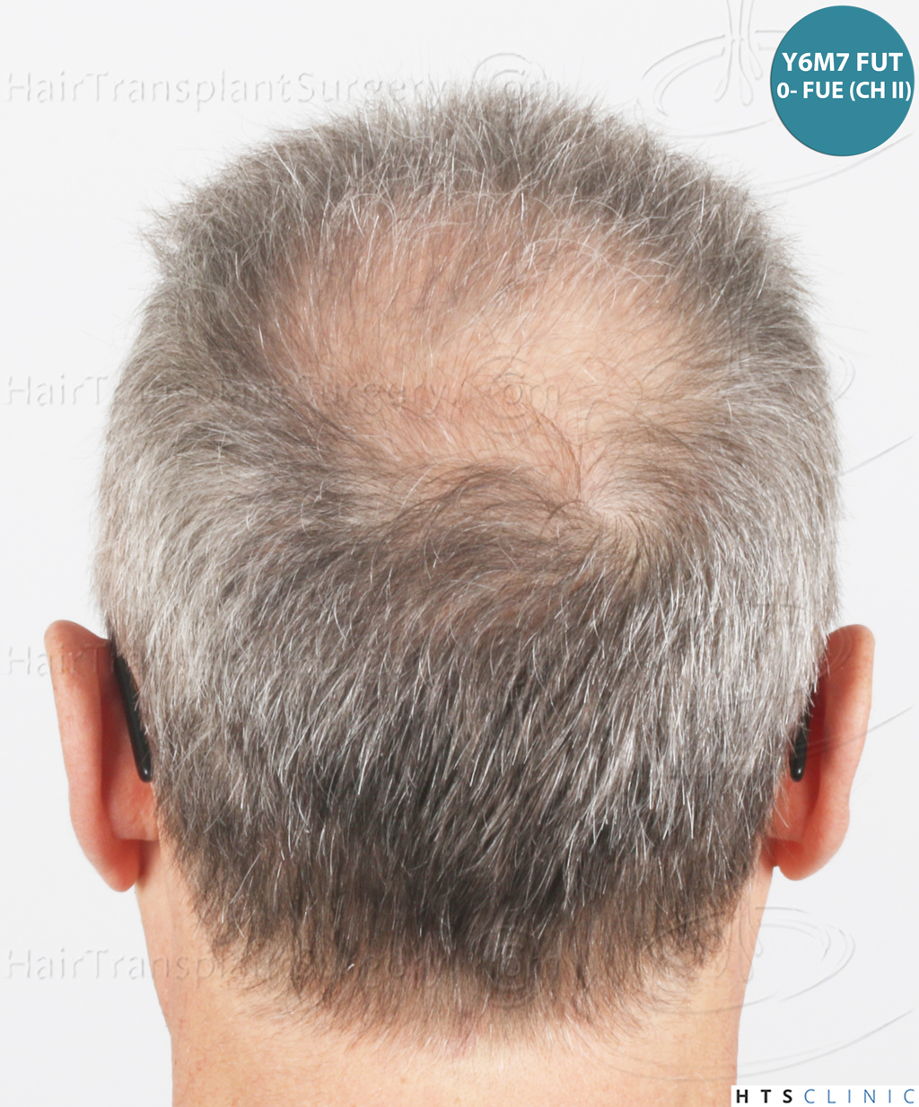 Dr.Devroye-Montesanti-Jenard-HTS-Clinic-