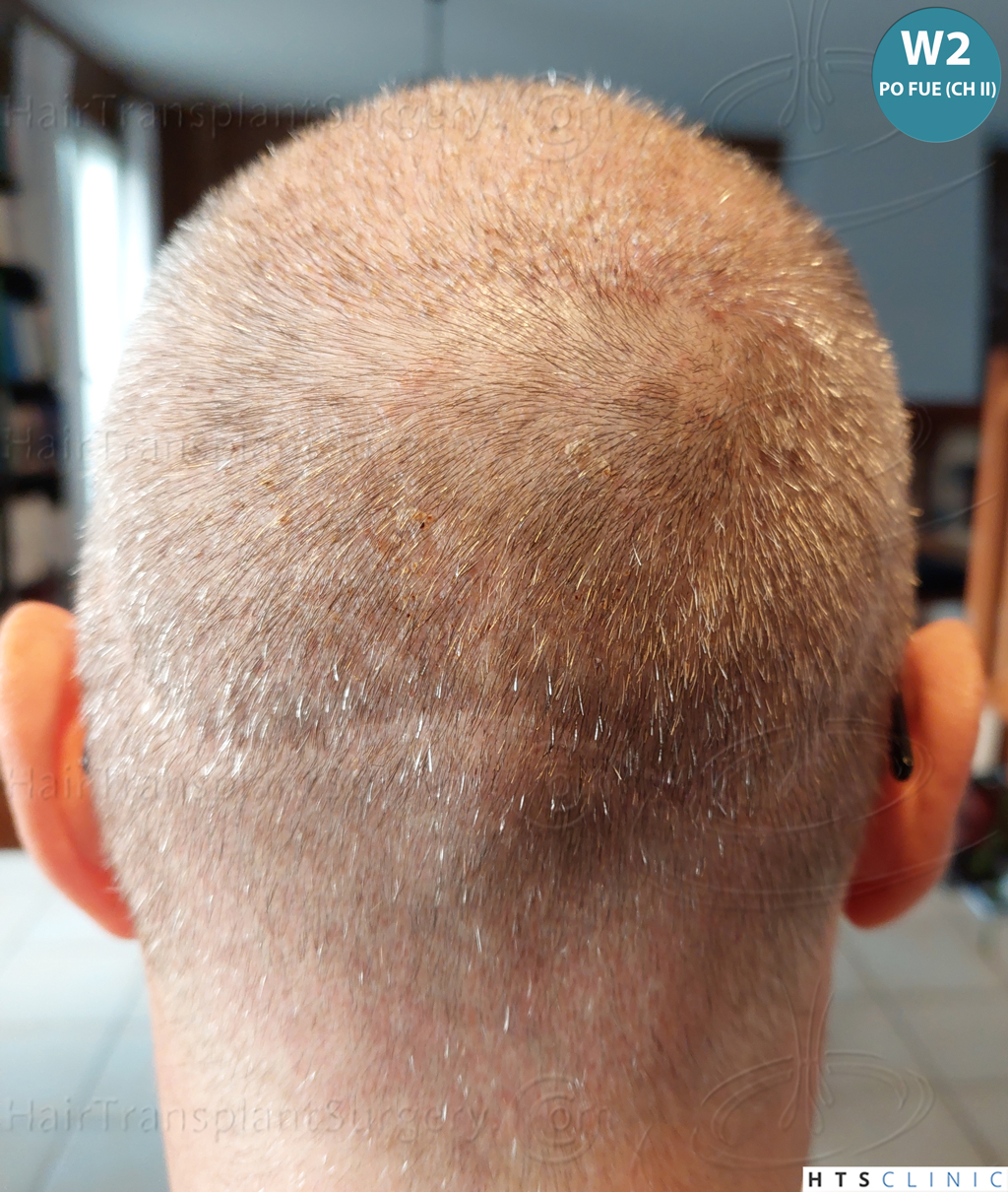 Dr.Devroye-Montesanti-Jenard-HTS-Clinic-