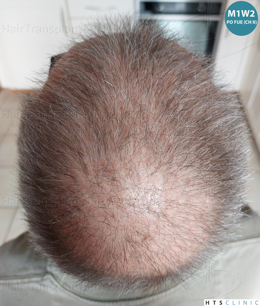 Dr.Devroye-Montesanti-Jenard-HTS-Clinic-