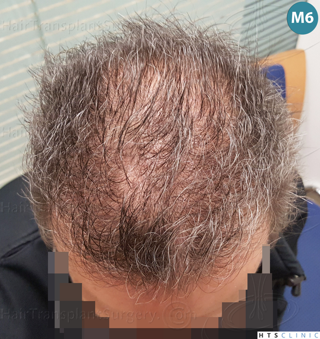 Dr.Devroye-Montesanti-Jenard-HTS-Clinic-