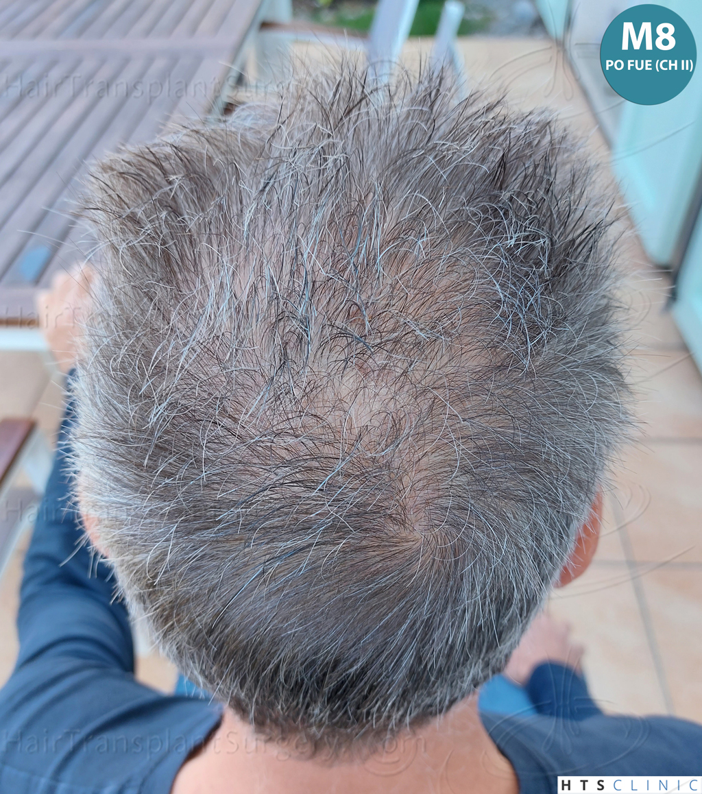 Dr.Devroye-Montesanti-Jenard-HTS-Clinic-