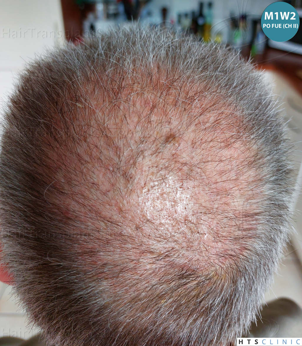 Dr.Devroye-Montesanti-Jenard-HTS-Clinic-