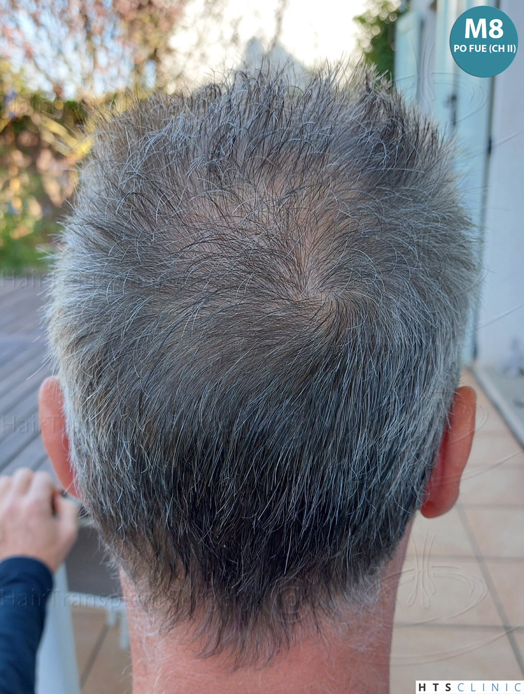 Dr.Devroye-Montesanti-Jenard-HTS-Clinic-