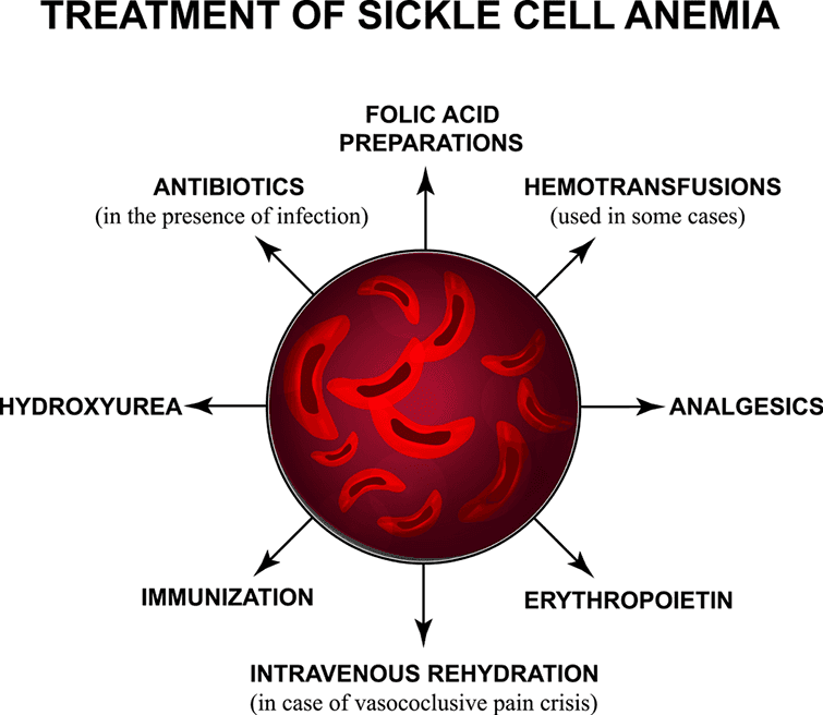 Sickle Cell Anemia (SCA): Causes, Symptoms And Treatment