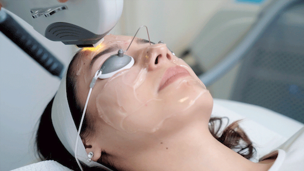 Woman with gel on face getting laser facial at Skin Laundry