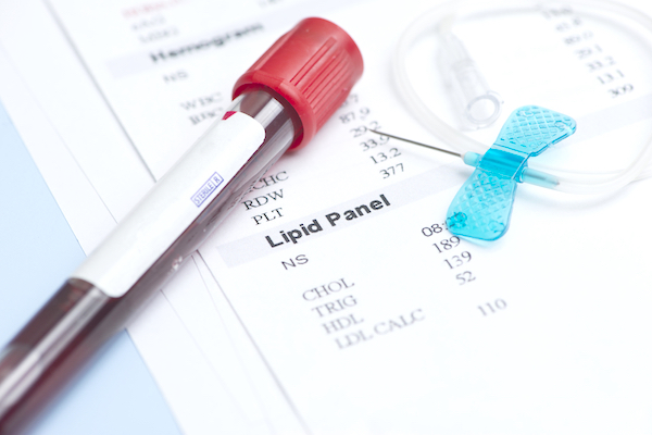 Lipid Panel Test - Triglyceride Levels - The Wellnest by HUM Nutrition