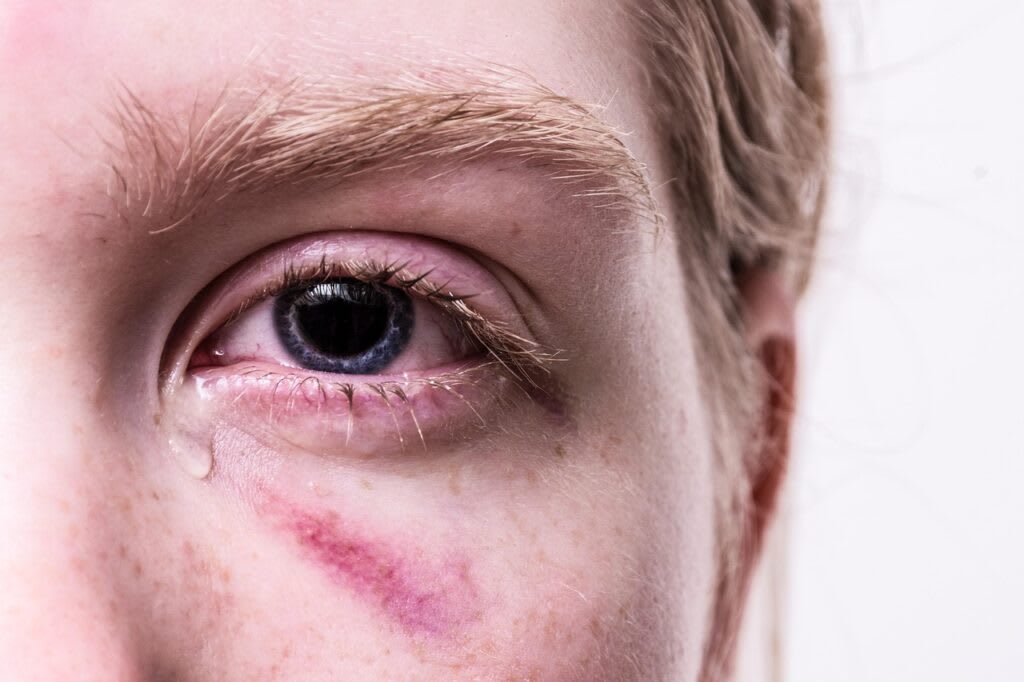 A person with tears and visible emotion, showing pain and resilience