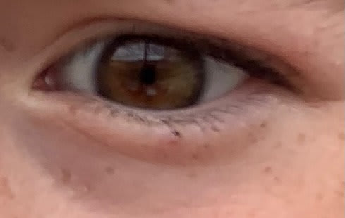 EMDR therapy session image 2