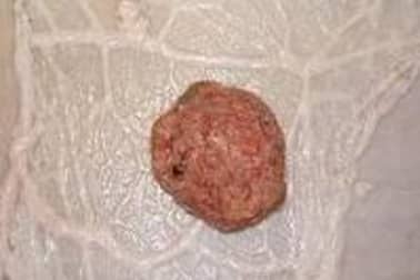 Les crépinettes - Etape 4