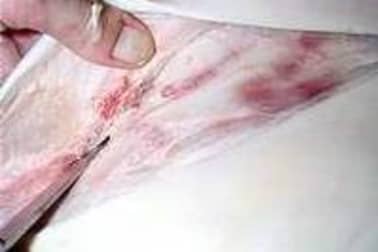 Tête de veau pochée - Etape 2