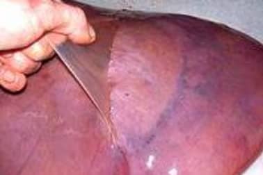 Foie de veau - Etape 2