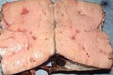 Foie de veau sauté - Etape 4