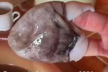 Préparation du poulpe - Etape 6