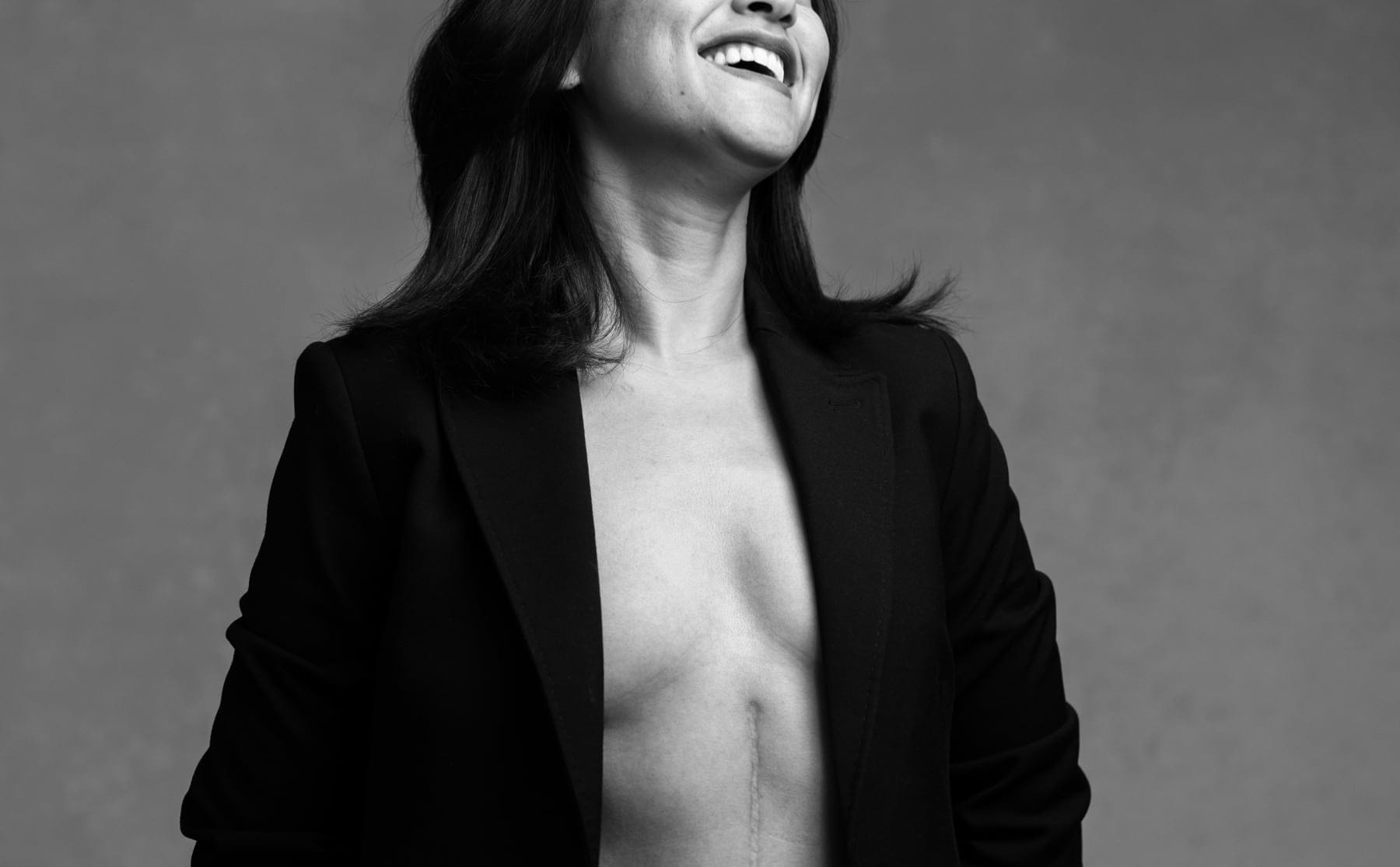 esmeralda-leeft-met-kanker-je-mindset-is-even-krachtig-als-je-lichaam-image Esmeralda leeft met kanker: ‘Je mindset is even krachtig als je lichaam’