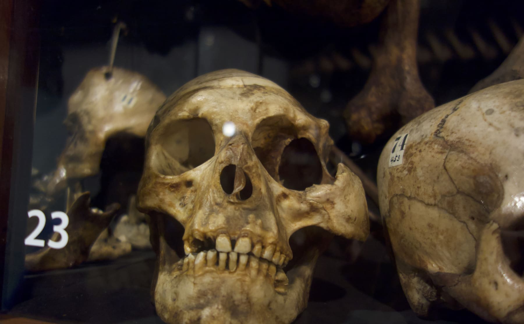 alleen-met-een-sterke-maag-binnenkijken-bij-museum-vrolik-image Alleen met een sterke maag: binnenkijken bij Museum Vrolik