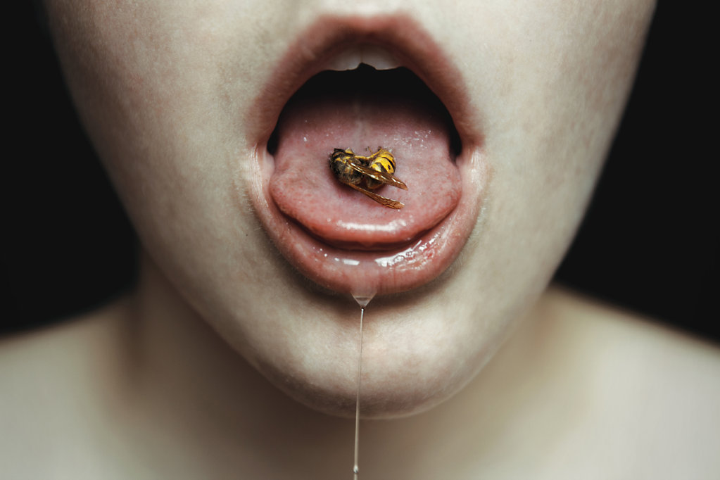 Bee Sting