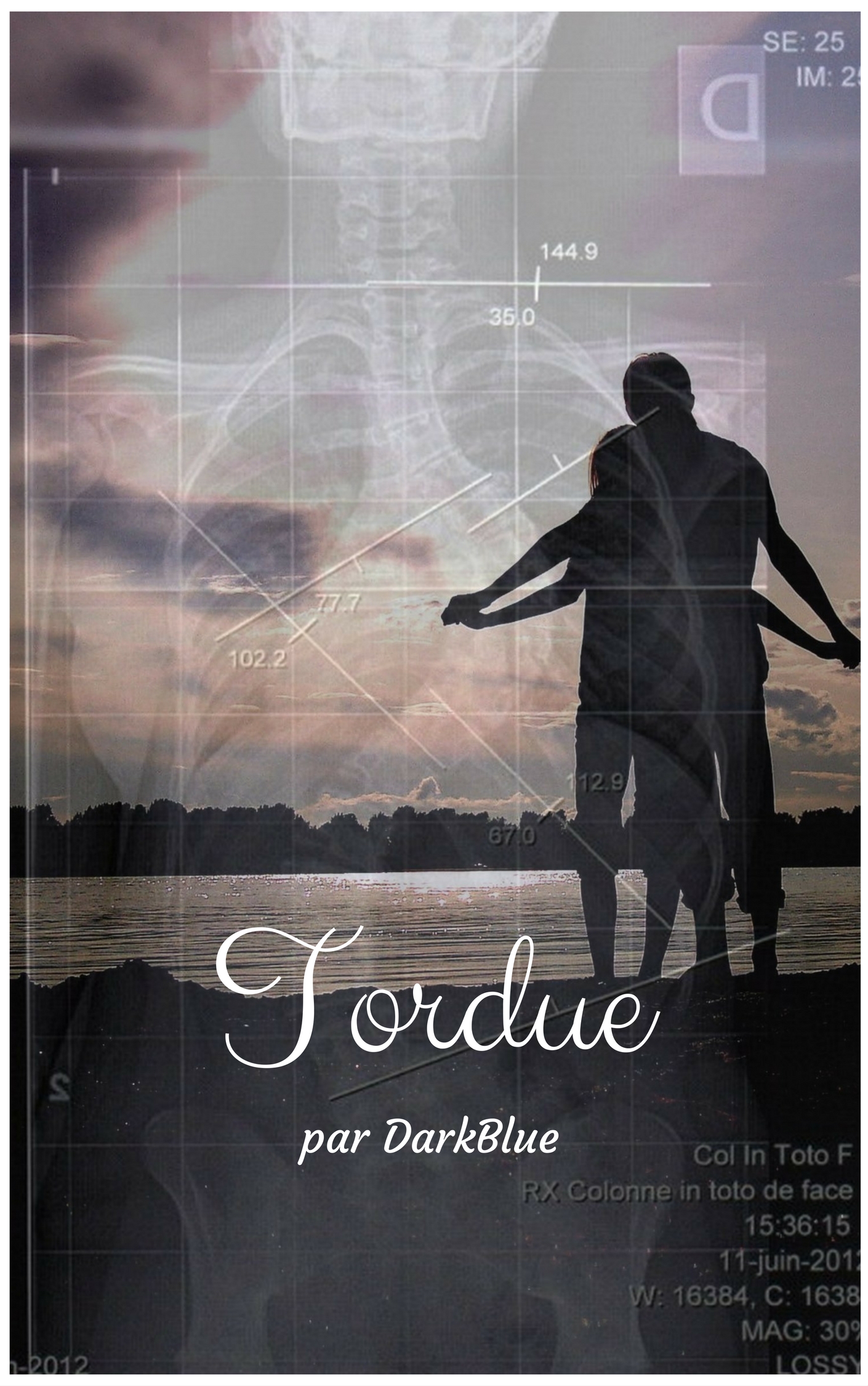 Tordue