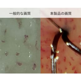 頭皮血流観察Autofocusマイクロスコープ