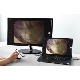 携帯型LED顕微鏡マジックルーペ アール 3R-MJL03