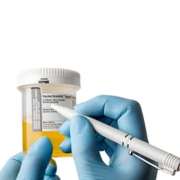 試料コンテナ 120mL ホワイト 滅菌 75×4入