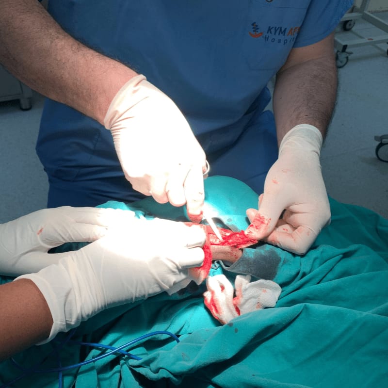 Gloves and surgical tools are used in the foreground to perform a medical procedure, while a person in scrubs stands in the background.