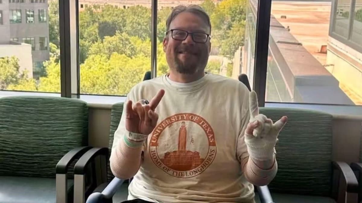 A smiling man with bandaged hands sits in a wheelchair in front of a window overlooking trees and buildings.