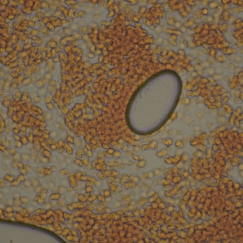 In the foreground, a cluster of adipocytes and blood vessels are visible, while the background reveals several circular structures containing smaller cells.